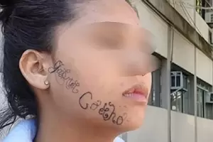 Su exnovio la secuestr y le tatu el nombre en la cara para marcarla como su propiedad