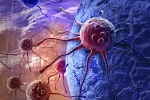 La ciencia avanza contra el cncer: prueban con xito una vacuna para eliminar tumores resistentes