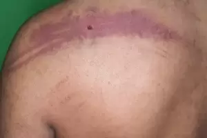 Denuncian torturas en una comisara de Fiambal