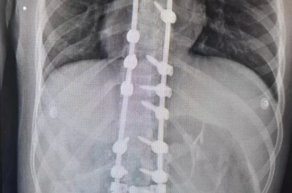 Nuevo logro en el Hospital "San Juan"