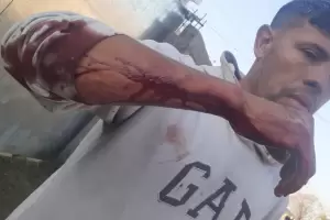 Dos hombres envueltos en una gresca con armas blancas resultaron heridos