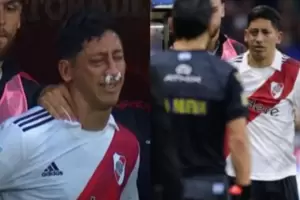 Aliendro fue operado de su grave lesin: microplacas de titanio, tornillos y visita de Gallardo en el hospital