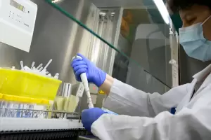 Salud envi muestras de influenza al ANLIS Malbrn para determinar el tipo que est circulando