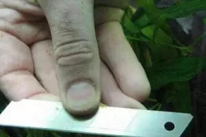 Violencia: le cortaron el rostro con una trincheta