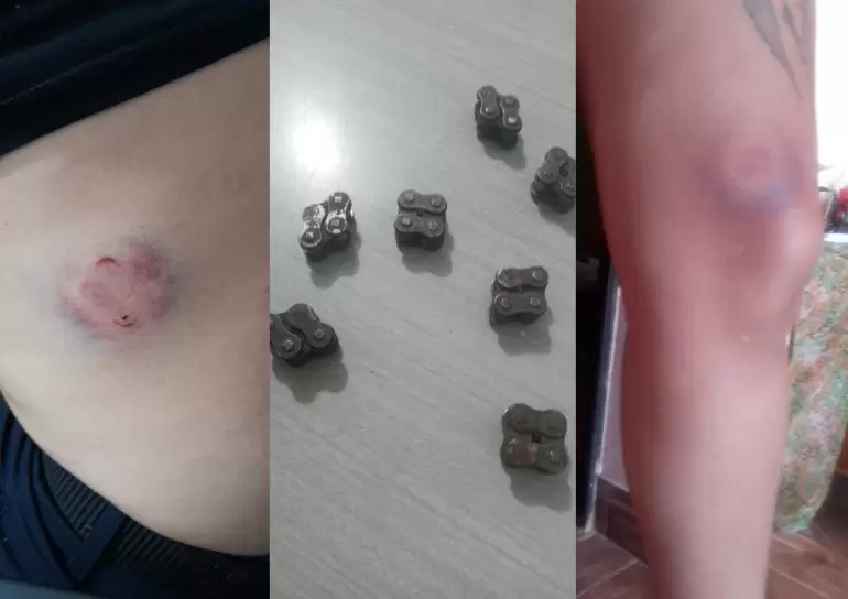 Denuncian ataque antiminero a policas y trabajadores de la empresa MARA