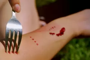 Un sujeto atac� a su pareja con un tenedor