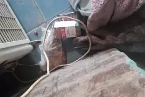 Aberrante: Golpe a su hijastra de 5 aos y la oblig a consumir drogas y comida para perro