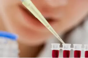 Enfermedad de Fabry: encuentro de pacientes para concientizar sobre la afeccin en Catamarca