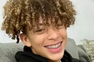 Quiso cumplir un desafo de TikTok y termin con quemaduras en el 80% de su cuerpo