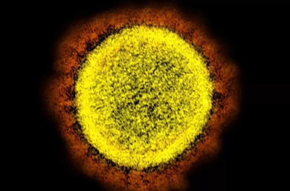 Una partcula del SARS-CoV-2 aislada en laboratorio y observada con microscopio.
