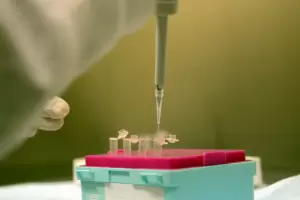 Streptococcus pyogenes: por qu la bacteria est ms agresiva y el caso confirmado en Catamarca