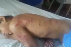 Un nene de 9 aos fue brutalmente atacado por al menos 16 perros en Mar del Plata