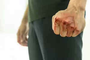 En La Plata, un adolescente discuti con un vecino y lo mat a apualadas