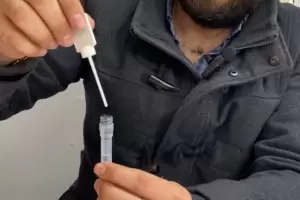 Comenz la campaa de prevencin de cncer de colon