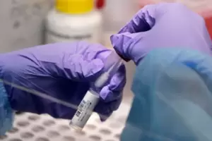 En Catamarca "est en riesgo la continuidad del servicio de anlisis clnicos"