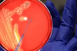 La enfermedad mortal que vuelve a Argentina tras una dcada de mejora