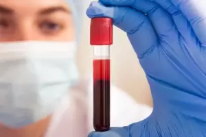 Startup Argentina: recibi un premio por su trabajo en la deteccin de 50 tipos de cncer