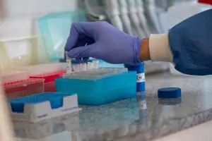 Bioqumicos comenzaron a suspender la atencin de algunas obras sociales