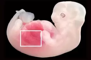 Hito cientfico: crearon rganos artificiales por primera vez, cultivando riones humanos en cerdos