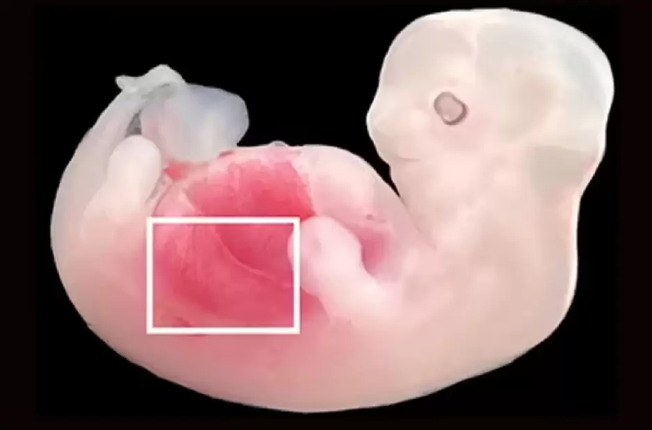 Por primera vez, cultivan riones que contenan clulas humanas en cerdos