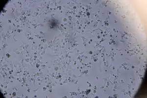 Encuentran un v�nculo inesperado entre el Covid y la agresividad del dengue