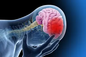 Da Mundial del ACV: de qu se trata, los sntomas y recomendaciones para prevenirlo