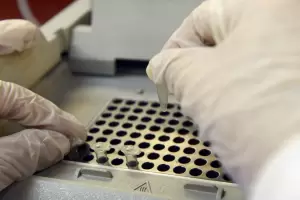 Streptococcus pyogenes: se aceleran los casos graves