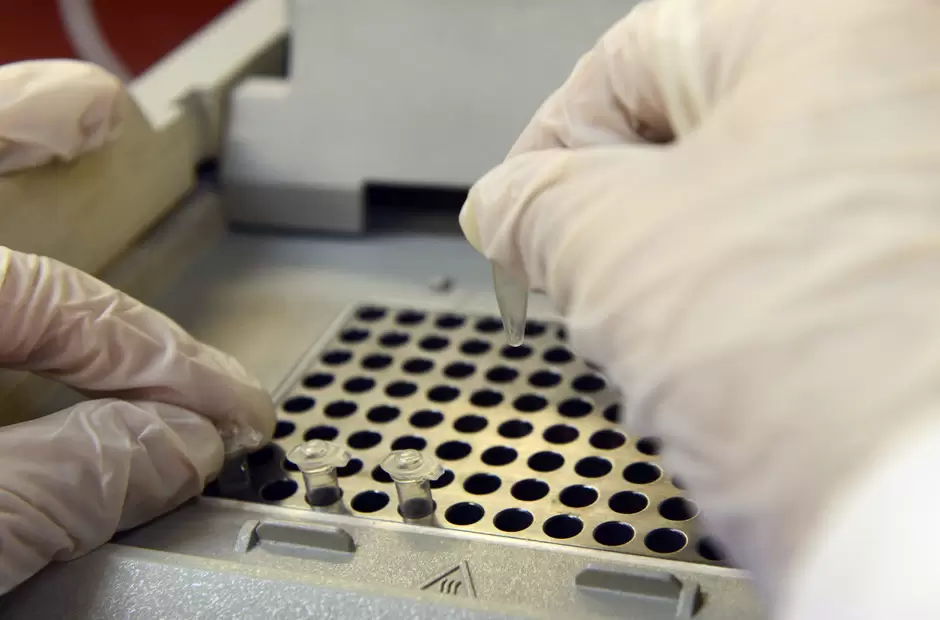 Streptococcus pyogenes