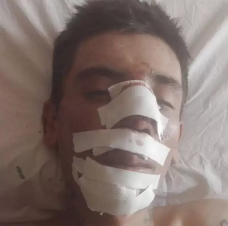 ataque en tinogasta. alans