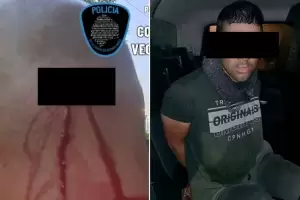 Indigente apual en la cabeza a un polica porque no quiso darle dinero