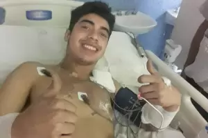 Impresionante: un joven fue alcanzado por un rayo y sobrevivi