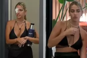 Gran Hermano 2024: Sabrina Cortez apareci con un parche en el ojo y caus preocupacin