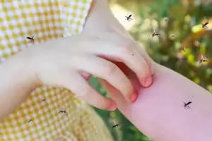 Ante el aumento de casos, estas son unas estrategias creativas para ahuyentar a los mosquitos