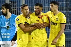 Hinchas de Rosario Central agredieron a un jugador de Pearol