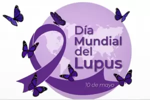 D�a Mundial del Lupus: �por qu� se conmemora el 10 de mayo?