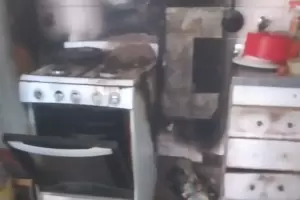 Una sexagenaria sufri quemaduras en el rostro mientras cocinaba