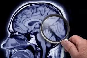 Da Mundial de la Lucha contra la ELA: 5 claves para entender causas, sntomas y tratamientos