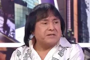 Ricky Maravilla reapareci tras un retoque esttico y gener sorpresa en las redes