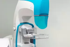 Dos oferentes para la compra de nuevo mamgrafo para el Hospital San Juan Bautista