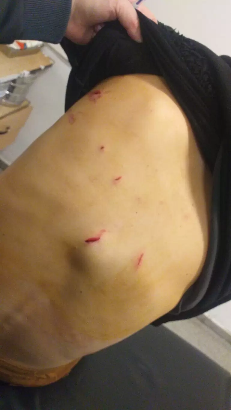 motociclista-apualado