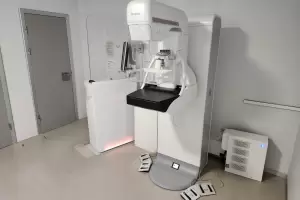 Finalmente el Hospital San Juan tendr un nuevo mamgrafo