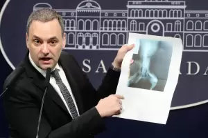 El Gobierno inicia exhaustiva revisin de pensiones por invalidez laboral en Argentina