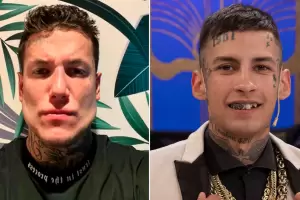 Alex Caniggia se burl de los nuevos dientes de L-Gante y la respuesta del cantante fue letal: "Los tenas peor"