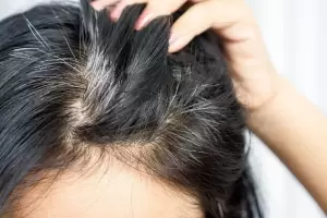 Tens canas y no quers usar tintura? estos son los trucos e ingredientes caseros para disimularlas