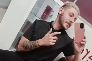 Viruela del mono: muri el joven cordobs que contrajo la enfermedad en Mxico