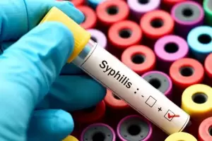 Alerta en Argentina por un pico histrico de sfilis