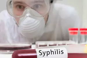 Sfilis en Catamarca: los casos se triplicaron en los ltimos tres aos