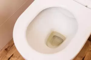 El truco para eliminar el sarro del inodoro con dos ingredientes de tu cocina