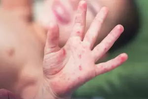 Cierre de la escuela de Santa Mara: "Es un virus comn en esta poca del ao"