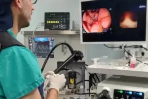 Presentaron novedosa tecnologa mdica para estudios gastroenterlogos
